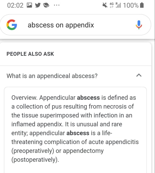 Appendular abscess